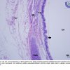 Tecido Epitelial de Revestimento Pseudo-Estratificado Cilíndrico Ciliado - Traquéia - 10x